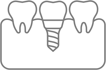 Icon zur Veranschaulichung von Implantatversorgung